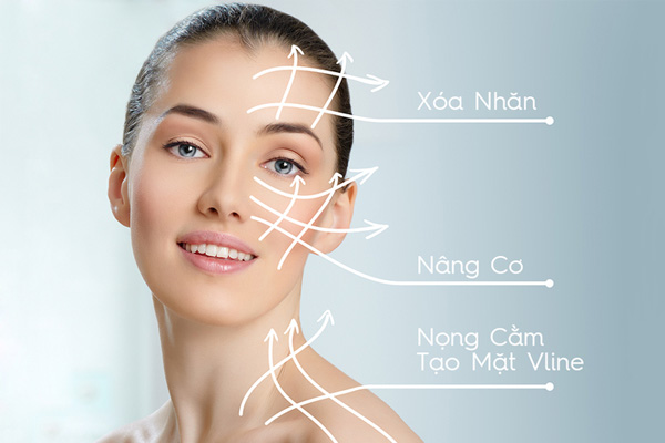 cấy chỉ thẩm mỹ