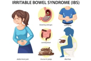 Châm cứu có làm giảm các triệu chứng IBS không?