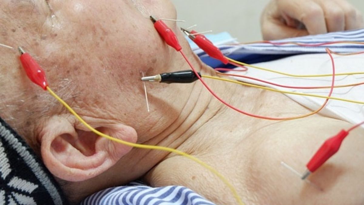 tai biến mạch máu não