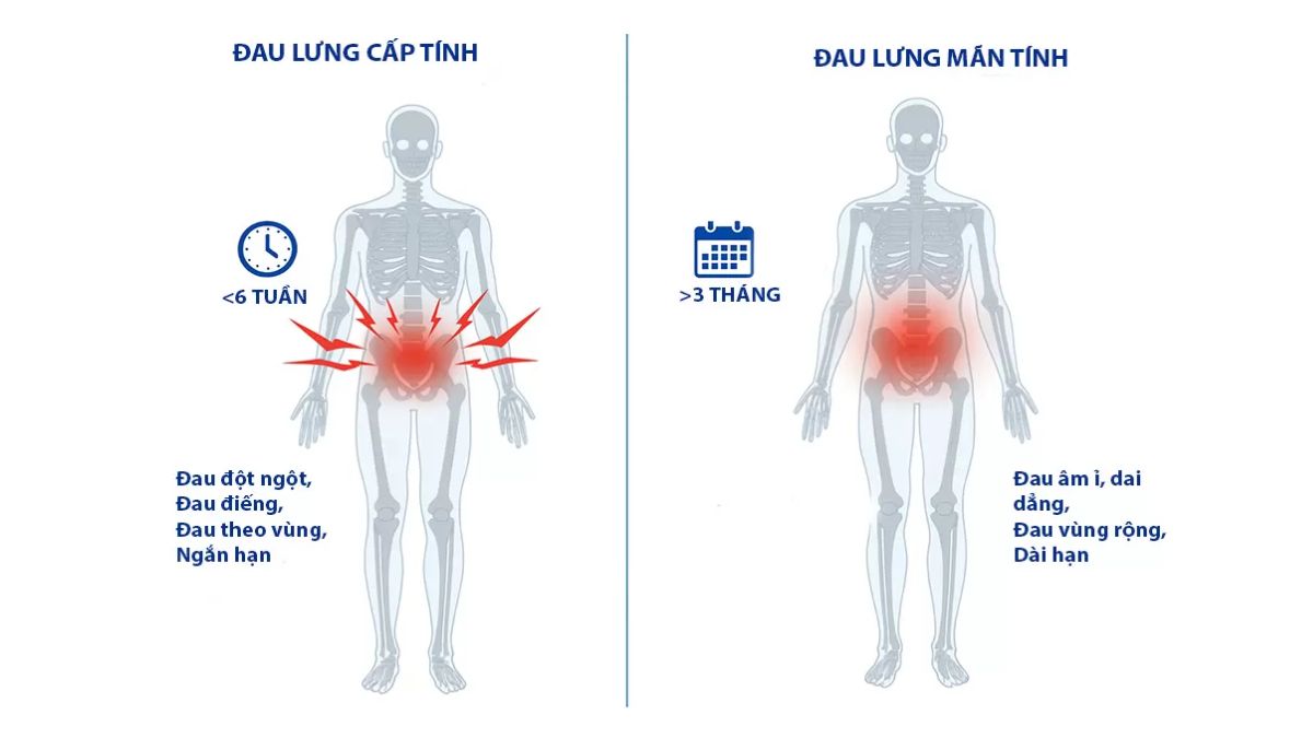 đau lưng cột sống