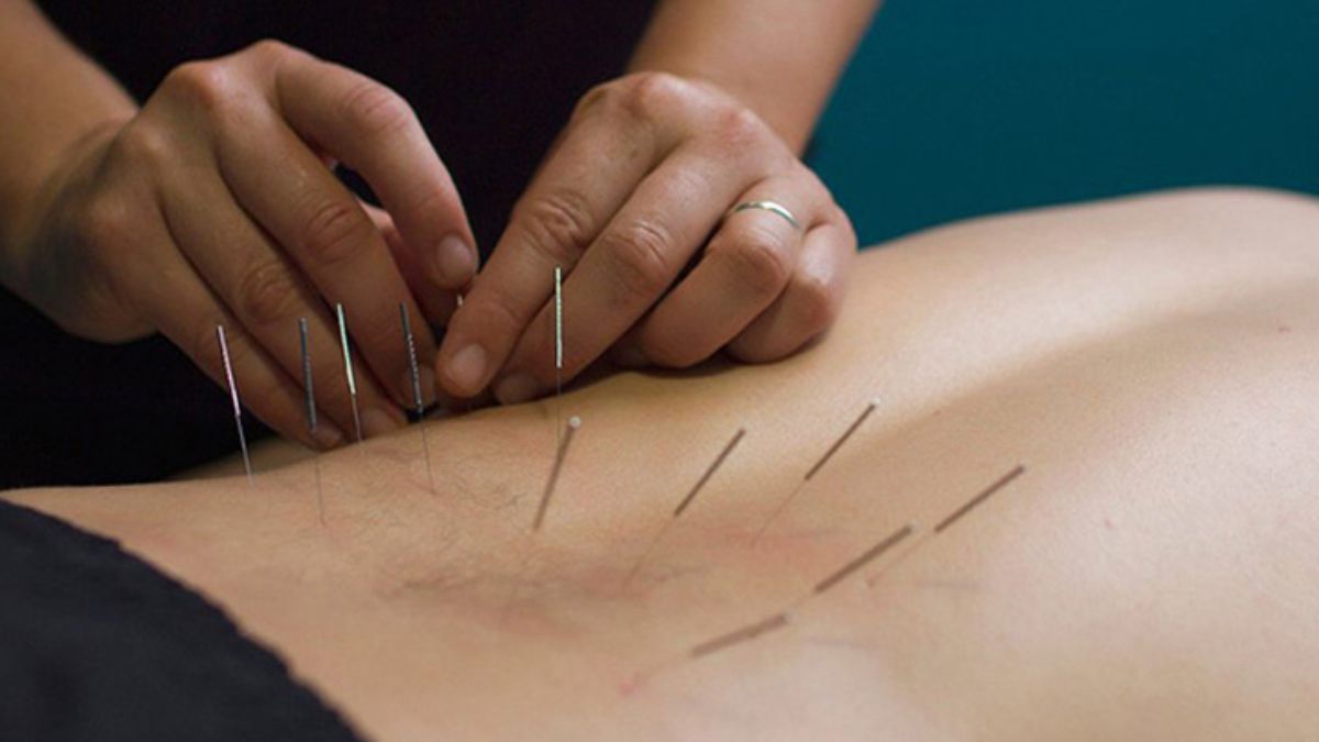 đau lưng cột sống