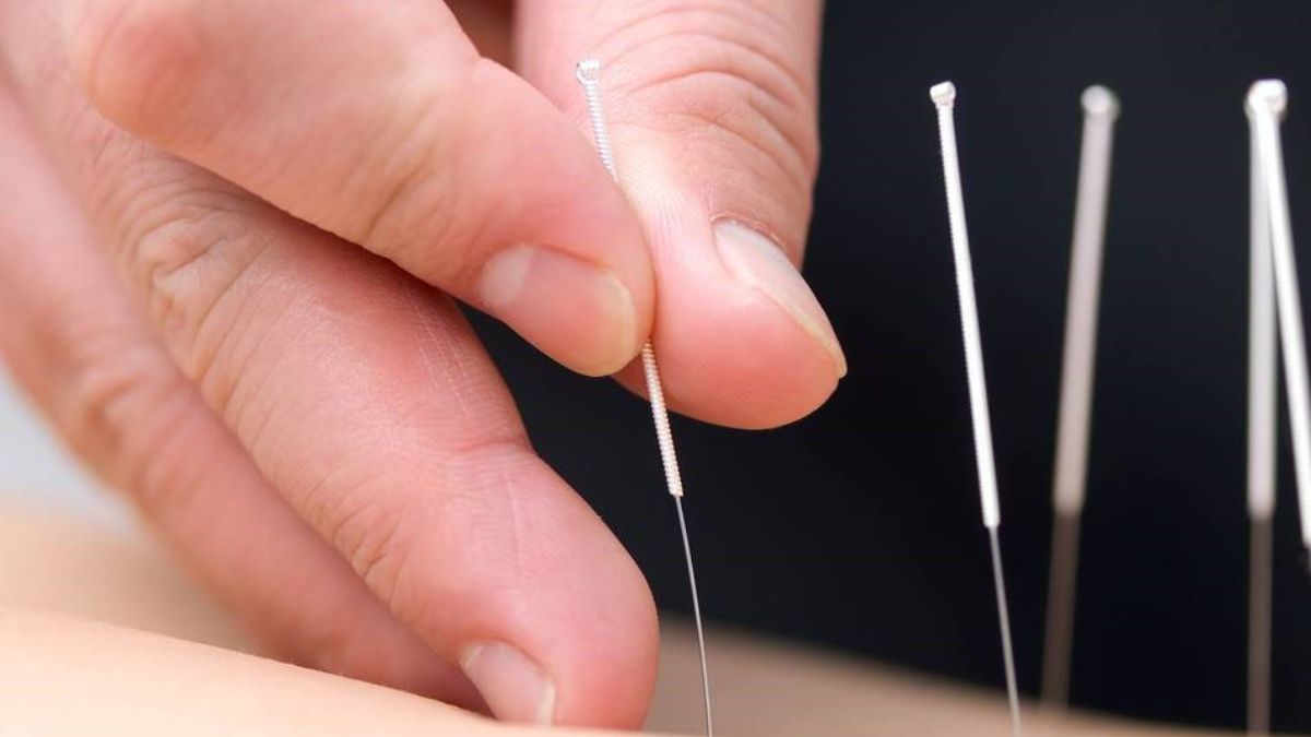 huyệt Uyển Cốt